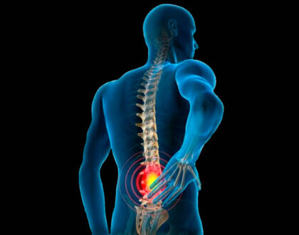 Evite a cirurgia! Como o Pilates pode tratar sua dor lombar